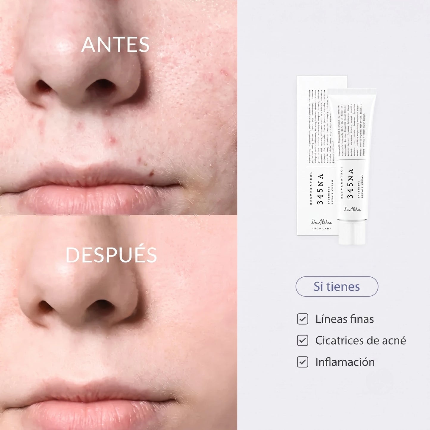 RELIEF™ | Crema hidratante regeneradora
